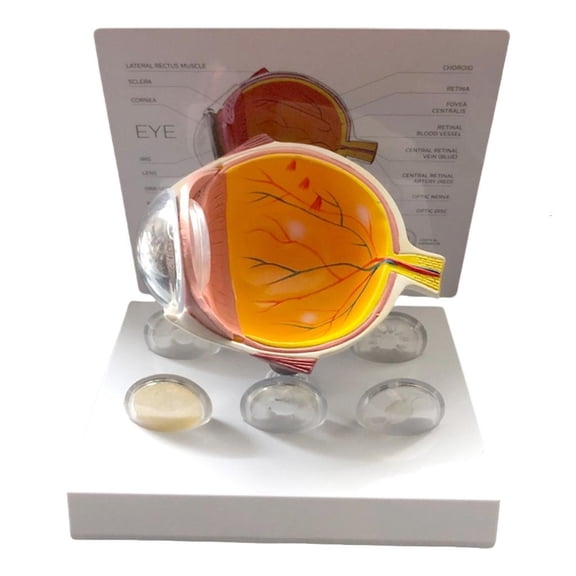 Human Anatomical Eye Model Realistic Pathological Eyeball Anatomy Model