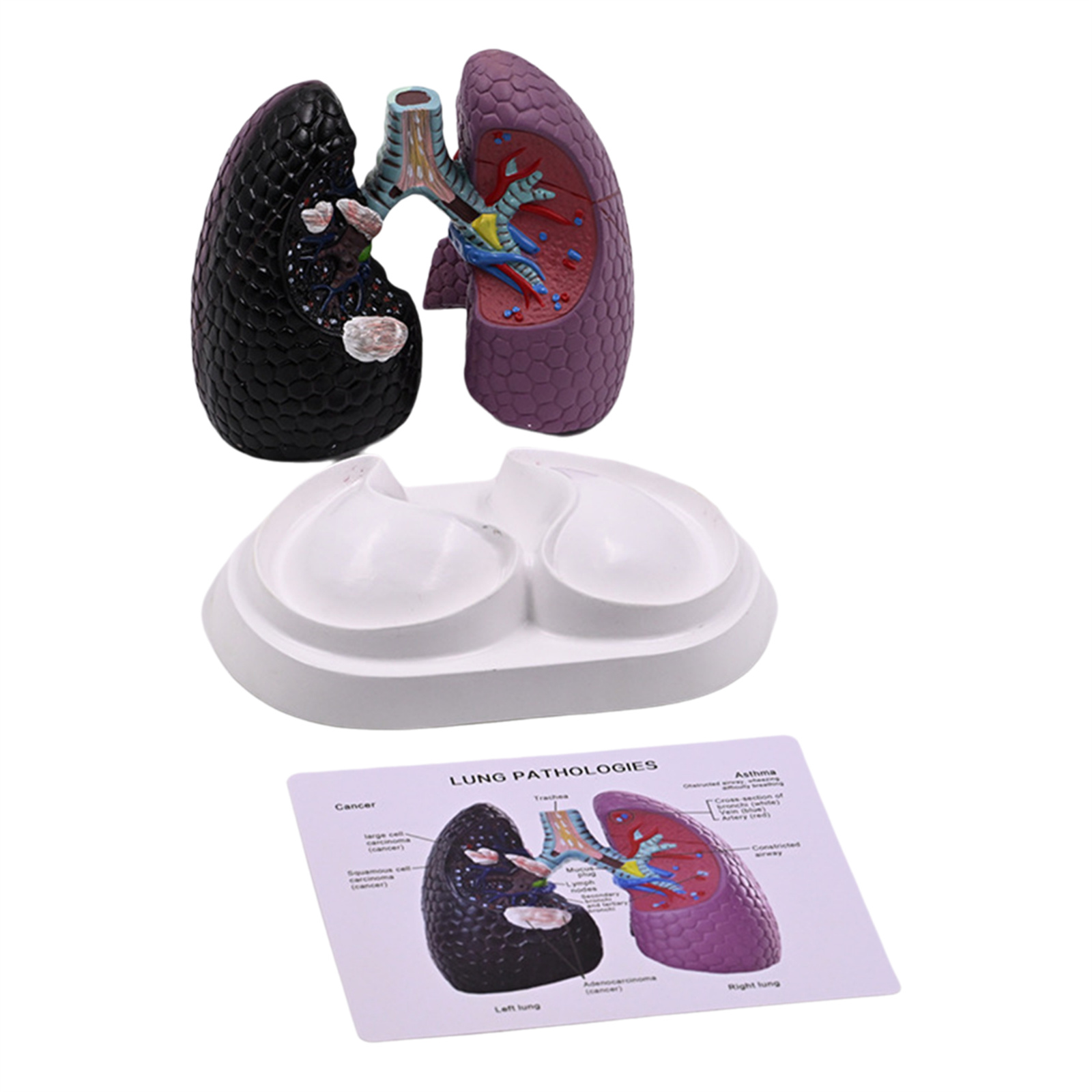 Human Anatomical Lung Model Normal and Pathological Lung Anatomy Model ...