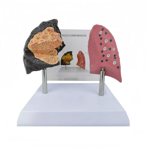 Human Anatomy Lung Model:Lung Model,Lung Health Smoking Model,1:1 Life Size 3D Human Anatomy Model,Human Respiratory System Lung Model,for Classroom Medical Display,Anatomy Study Tools