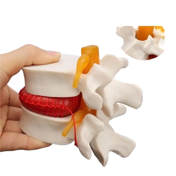 Human Anatomy Skeleton Spine Lumbar Disc Herniat Teaching Model, Brain Skull Traumatic Pistol School Supplies Medical Instrume