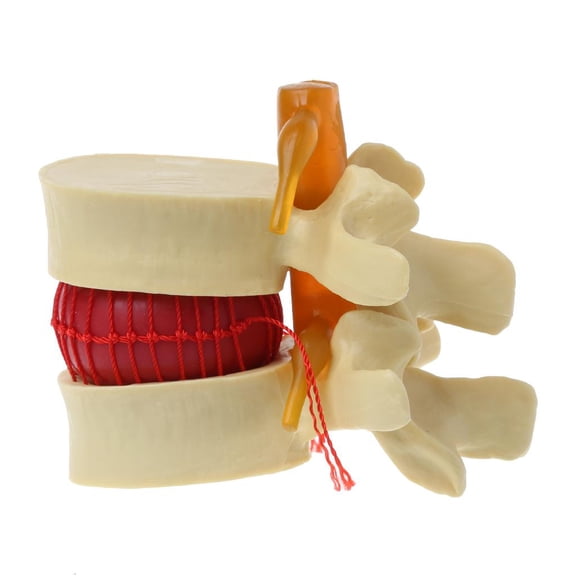 Human Anatomy Skeleton Spine Medical Props Model Anatomical Spine Lumbar Disc Herniation Anatomy Medical Teaching Tool