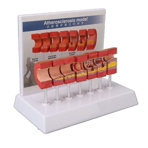 Human Arterial Anatomy Model, 7PCS Arterial Anatomy Model, Dissecting Blood Vessels Atherosclerosis Thrombosis Blood Vessel Model, Teaching Tool For Doctor's Office