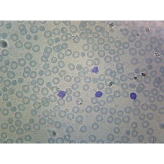 Human Blood; Smear; WR Stain by Go Science Crazy