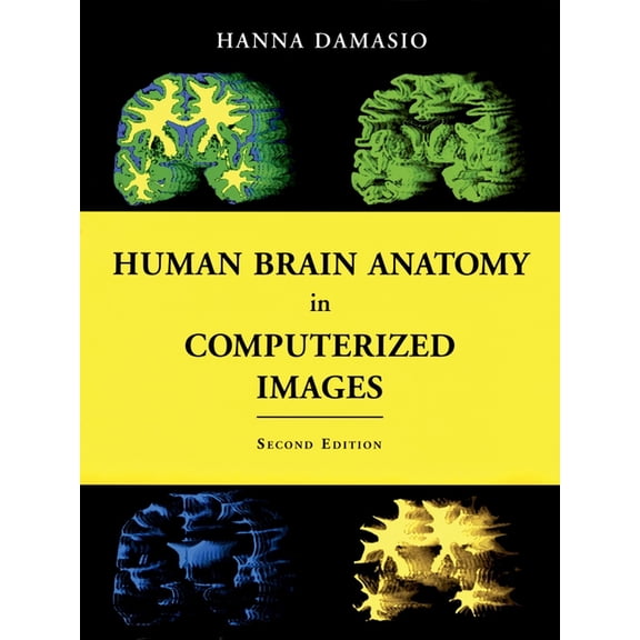 Pre-Owned Human Brain Anatomy in Computerized Images, (Hardcover)