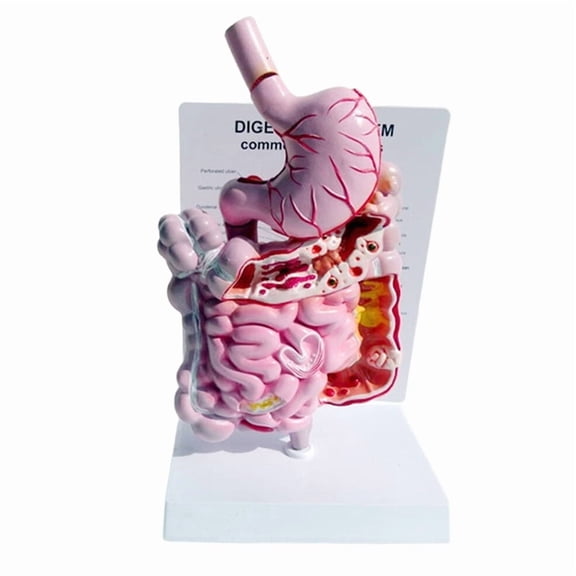 Human Digestive System Model Stomach Anatomy Intestine Cecum Rectum Duodenum Human Internal Organs Structure Model