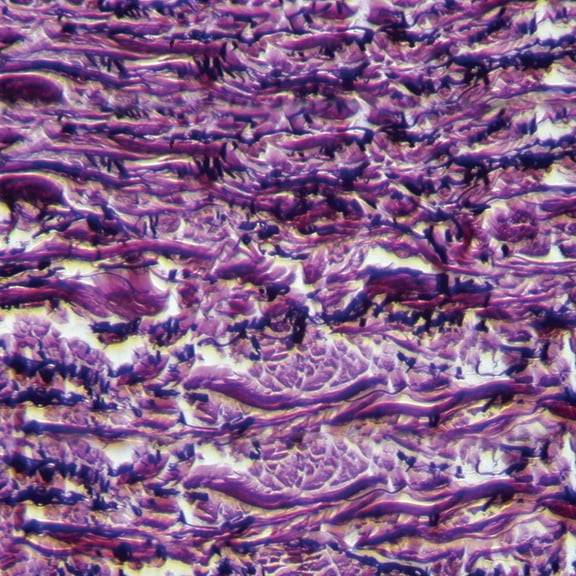 Human Elastic Tissue Slide, Sec., 7 M, Verhoeff's Stain