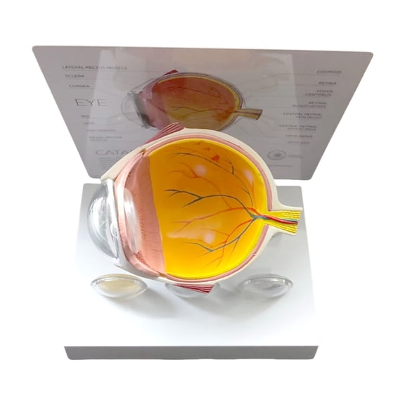 Human Eye Anatomy Model Realistic Pathological Model For Research Educational Use and Clinical Demonstration