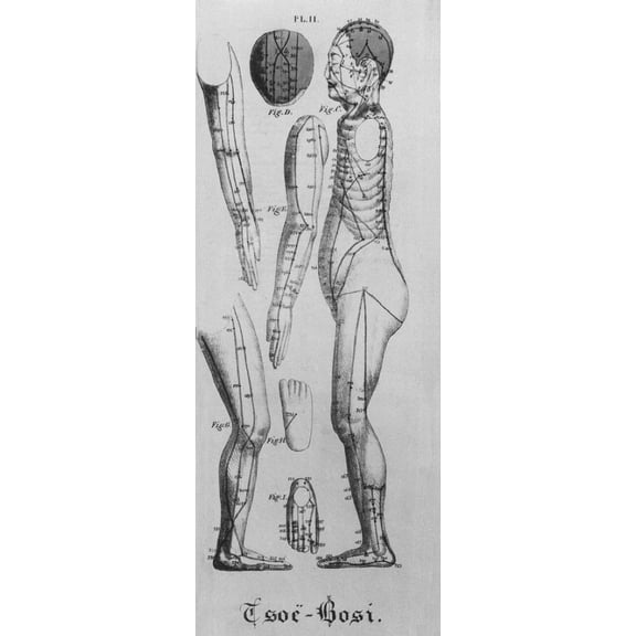 Human Figure Shown In Left Profile With Acupuncture Points And Meridians Identified. Also Shown Are Views Of The Head History (18 x 24)