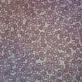 thumbnail image 1 of Human Iron Deficiency Anemia, Smear Microscope Slide, 1 of 1