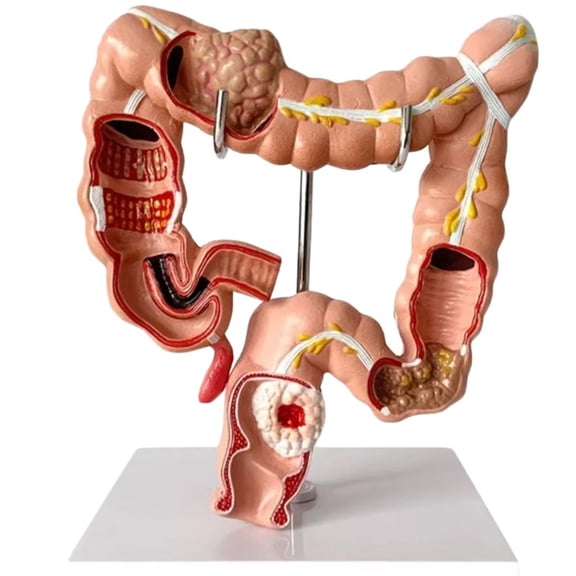 Human Large Intestine Anatomical Model Colon Pathology Model Human Anatomy Digestive System Display Model for Science Education