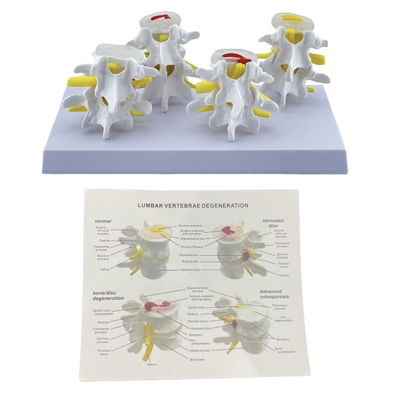 Human Lumbar Vertebrae Model Medicals Teaching Tool Human Lumbar Spine Anatomy Model School Teaching Supplies