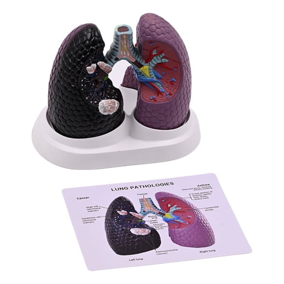 Human Lung Anatomy Model Realistic Pathological Lung Anatomy Model Teaching Tool