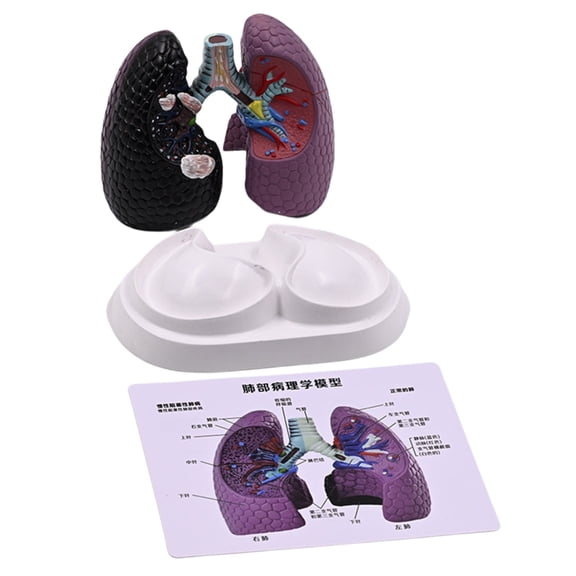 Human Lung Anatomy Model Realistic Pathological Lung Anatomy Model Teaching Tool