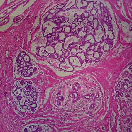 Human Mammary Gland Lactating 7 M H&E Stain Microscope Slide