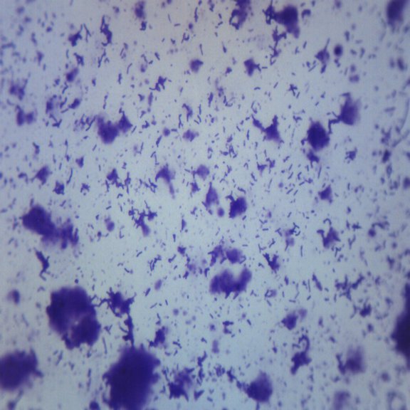 Microscope Slide Bacteria