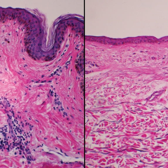 Human Pigmented And Non-Pigmented Skin Composite Sec. 7 M H&E Stain Microscope Slide