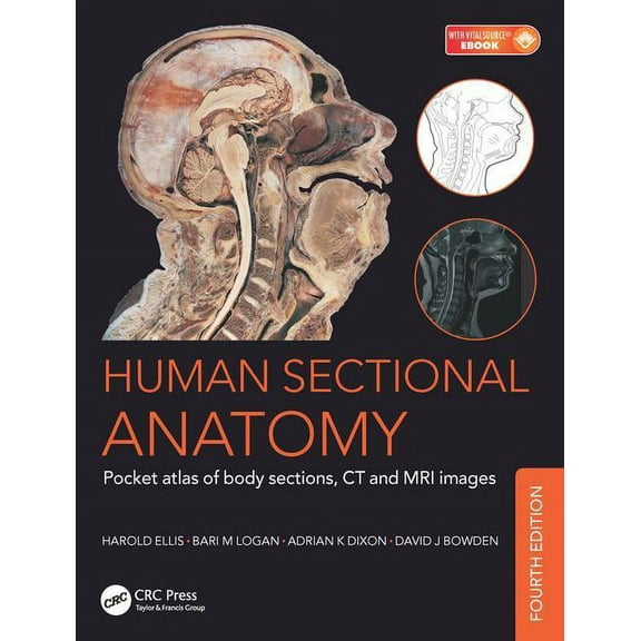 Human Sectional Anatomy: Pocket Atlas of Body Sections, CT and MRI Images, Fourth Edition (Paperback)
