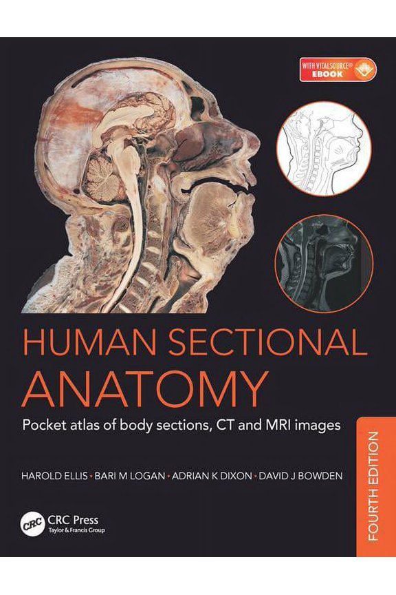 Human Sectional Anatomy: Pocket Atlas of Body Sections, CT and MRI Images, Fourth Edition (Paperback)