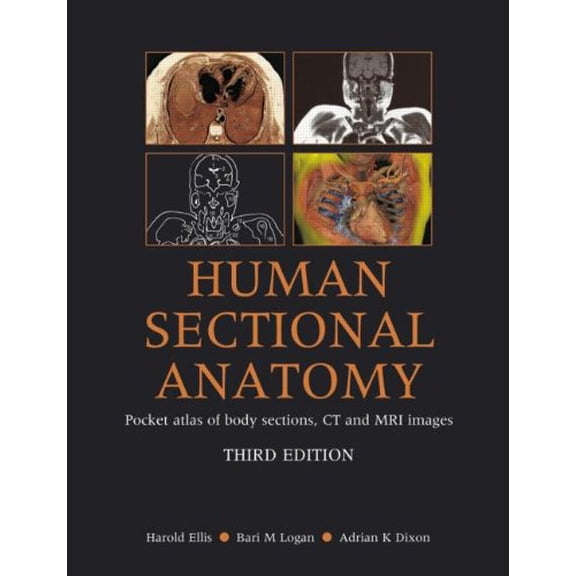 Pre-Owned Human Sectional Anatomy: Pocket Atlas of Body Sections, CT and MRI Images, Third Edition Paperback