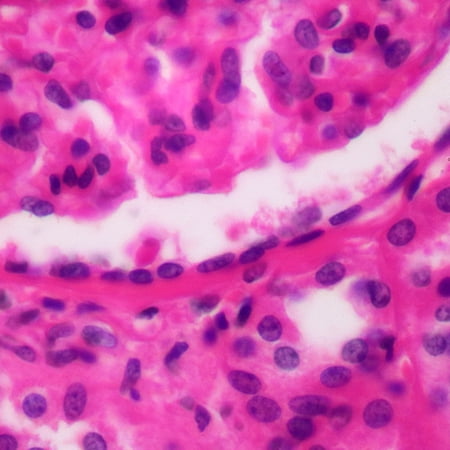 Human Simple Squamous Epithelium, Sec. 7 M, H&E Microscope Slide