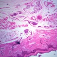 thumbnail image 1 of Human Skin Showing Sweat Glands Sec. 7 M H&E Stain Microscope Slide, 1 of 1