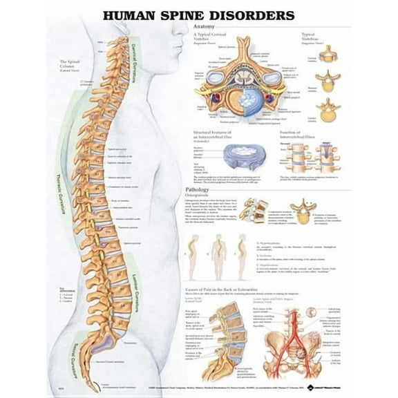 Human Spine Disorders Anatomical Chart