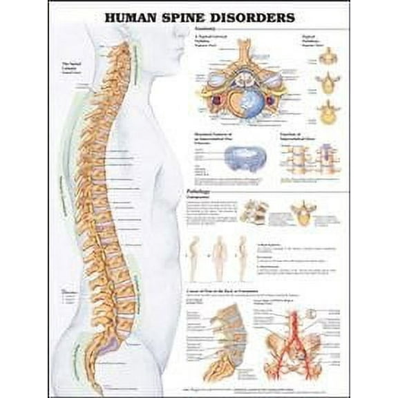 Human Spine Disorders Anatomical Chart