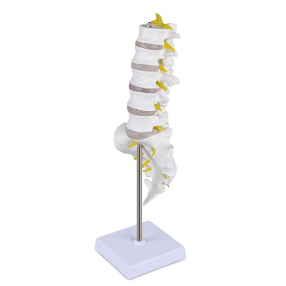 Human Spine Model with 5 Lumbar Vertebrae, Herniation Discs, Lumbar Nerves and Spinal Cord
