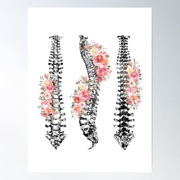Human Spine Poster Wall Art, Modern Wall Decor For Living Room Bedroom, 12x18 UNFRAMED