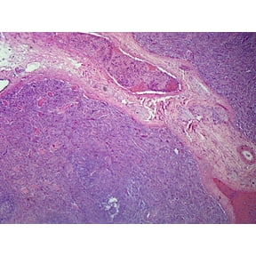 Human Spleen; Section; H&E Stain by Go Science Crazy