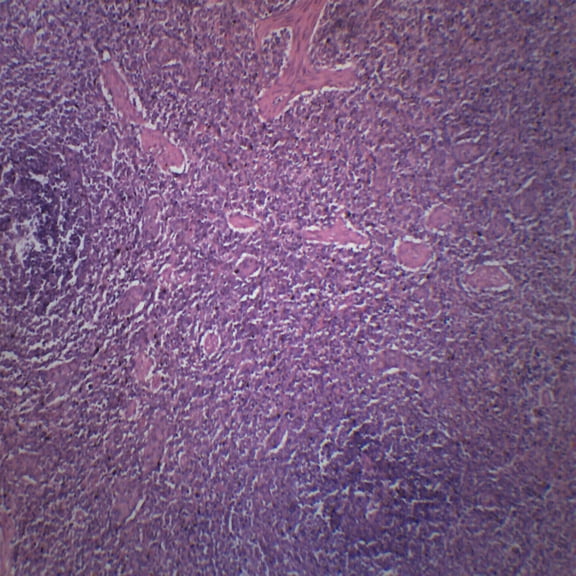 Human Spleen Section - HE Stain - Prepared Microscope Slide - 75 x 25mm - Biology & Microscopy - Eisco Labs