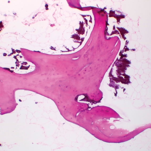 Human Spongy Bone, Sec. 7 M H&E Microscope Slide