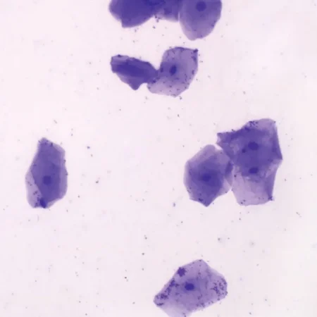 Human Stratified Squamous Epithelium Slide, Smear