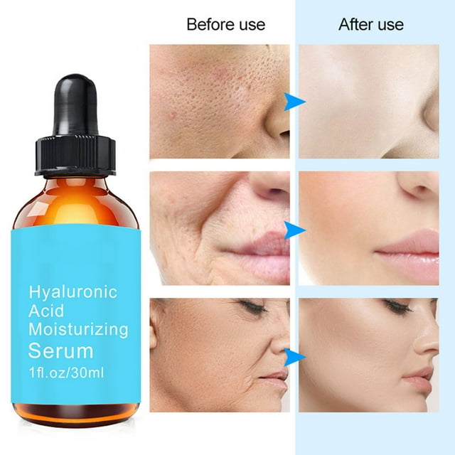 Hyaluronic Serum For Aging Face, Fine Lines, Dark Spots And Dry Skin(01)
