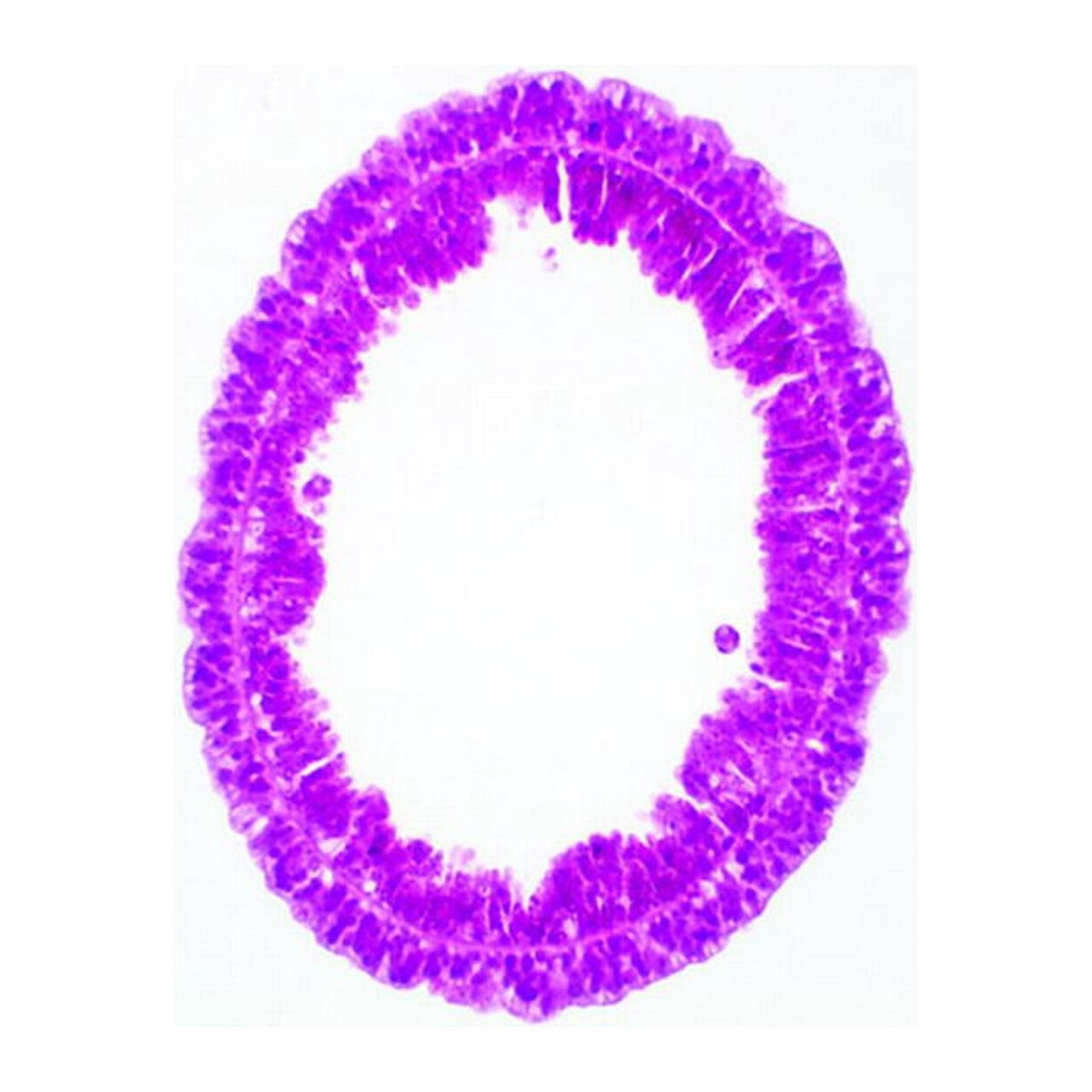 Hydra Cross Section Under Microscope Labeled