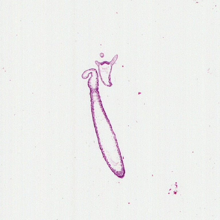 Hydra, L.S. H&E Microscope Slide - Walmart.com