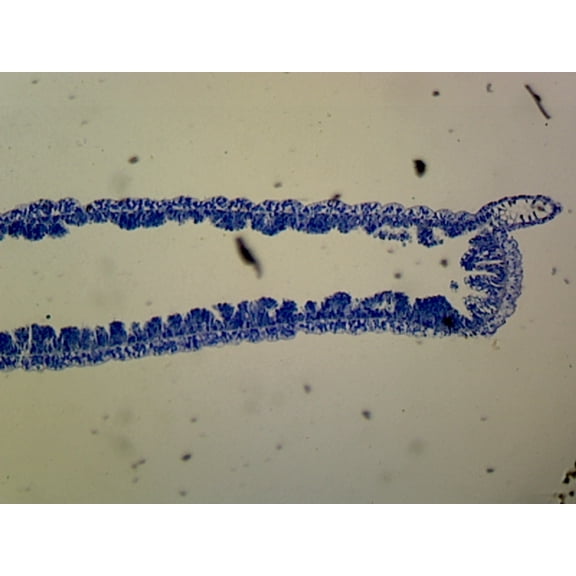 Hydra; Longitudinal Section; H&E Stain by Go Science Crazy
