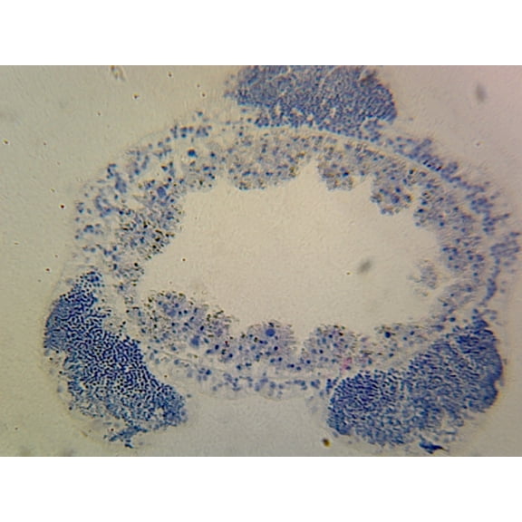 Hydra with Male Gonad (Spermary); Whole-mount by Go Science Crazy