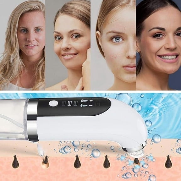 Hydrodermabrasion Device, Rechargeable Electric Blackhead Extractor with Vacuum Suction, Multifunctional Pore Cleaner for Deep Cleansing, Moisturizing and Safe Usage