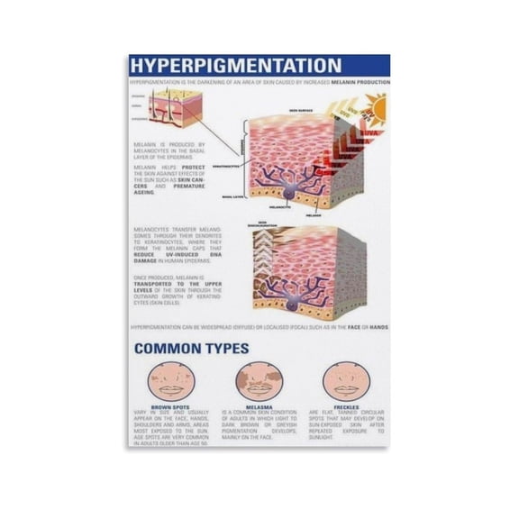 Hyperpigmentation Art Skin Care Tips Spa Poster Canvas Print Aesthetic Decor Bedroom Bathroom Preppy Dorm Home Posters Garage Decor
