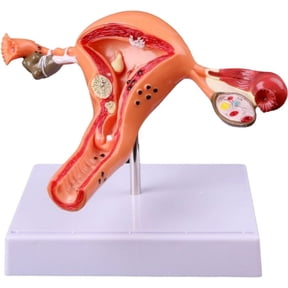 Hzzsbu Uterus Ovary Model Pathological Uterus Ovary Anatomical Model Anatomy Cross Section Study Tool Medical Props Model