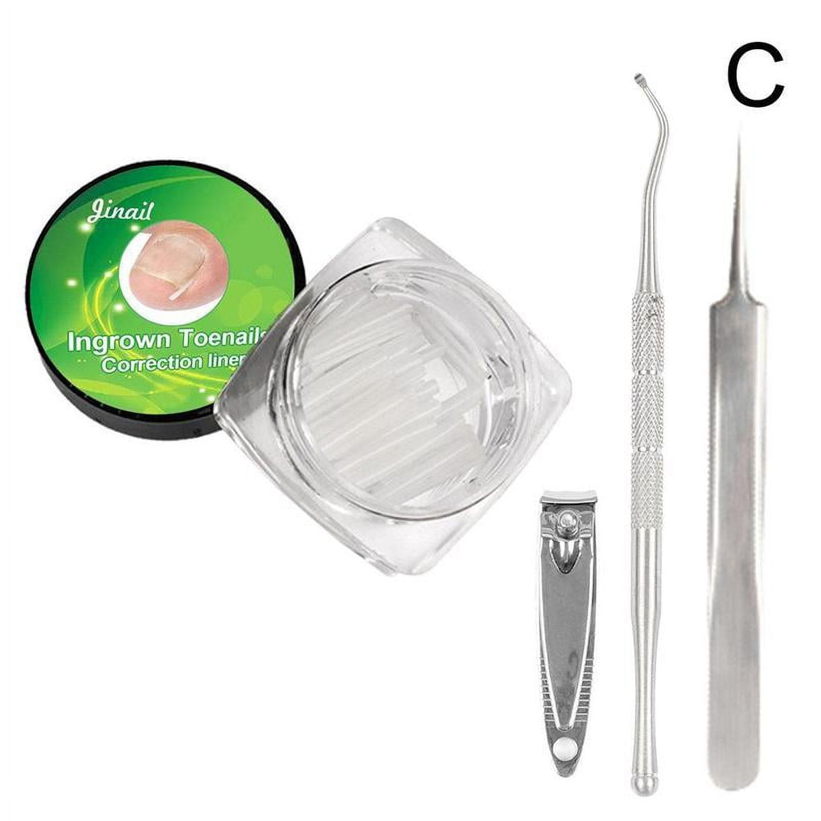 INGROWN TOENAIL TREATMENT Ingrowing Toe Nail Correction Care Pedicure Tool D9N9