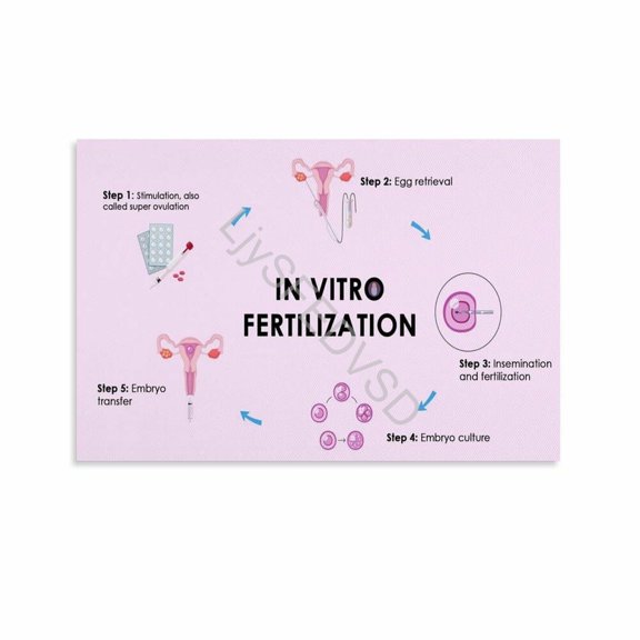 IVF Process Cycle Infographic Poster Fertility Educational Wall Art (27) Canvas Painting for Living Room Bedroom Decor poster
