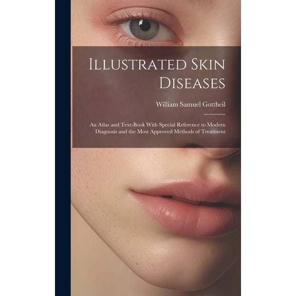 Illustrated Skin Diseases : An Atlas and Text-Book With Special Reference to Modern Diagnosis and the Most Approved Methods of Treatment (Hardcover)