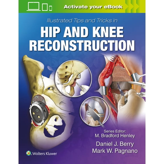 Illustrated Tips and Tricks in Hip and Knee Reconstructive and Replacement Surgery (Hardcover)