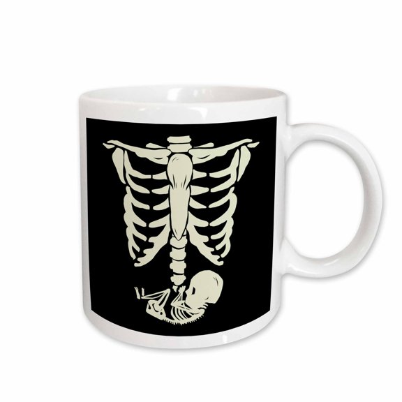 3drose, Illustration Design with Baby Skull Skeleton Birth, 11oz Mug
