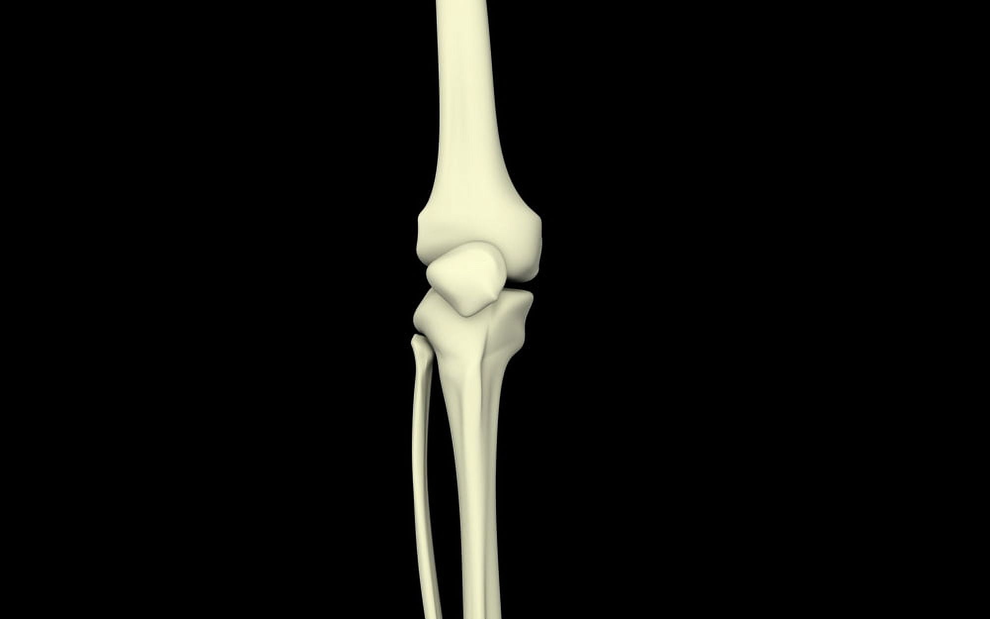 Illustration of knee bone straight Canvas Art - Stocktrek Images (36 x 23)