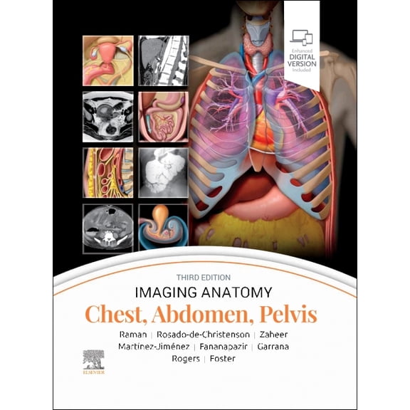 Imaging Anatomy Imaging Anatomy: Chest, Abdomen, Pelvis, (Hardcover)