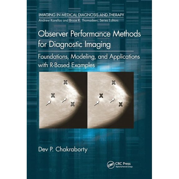 Imaging in Medical Diagnosis and Therapy Observer Performance Methods for Diagnostic Imaging: Foundations, Modeling, and Applications with R-Based Examples, (Paperback)