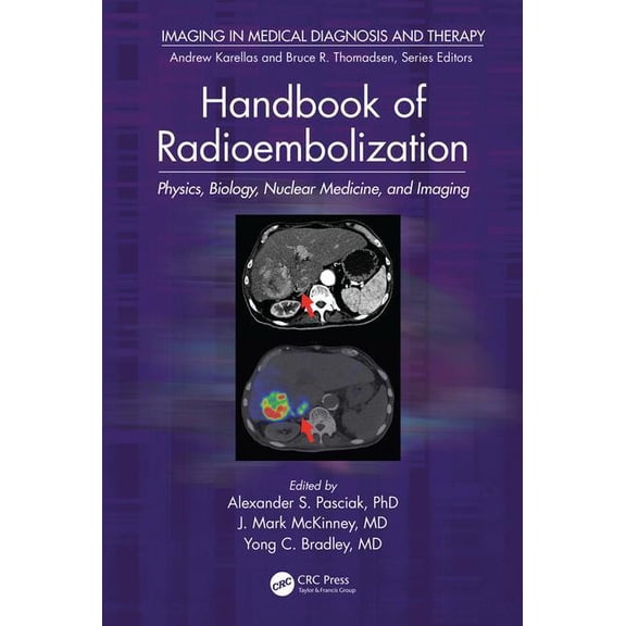 Imaging in Medical Diagnosis and Therapy Handbook of Radioembolization: Physics, Biology, Nuclear Medicine, and Imaging, (Hardcover)